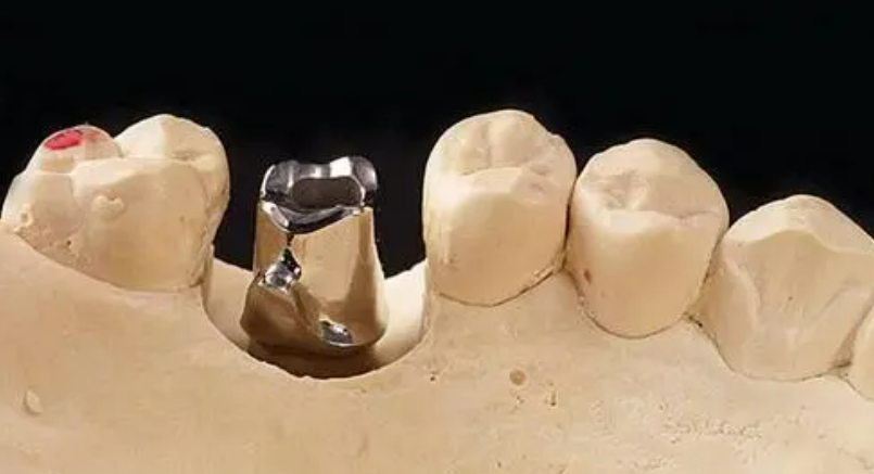 Pure Titanium Custom Abutment